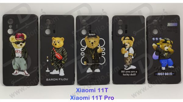 گارد ژله ای طرح دار شیائومی Xiaomi 11T